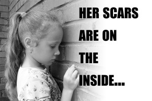 sad-girlgrey-her-scars-are-on-the-inside